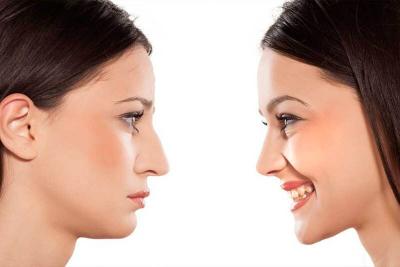 TreatMyWrinkles Southampton - Botulinum & Dermal Filler Experts